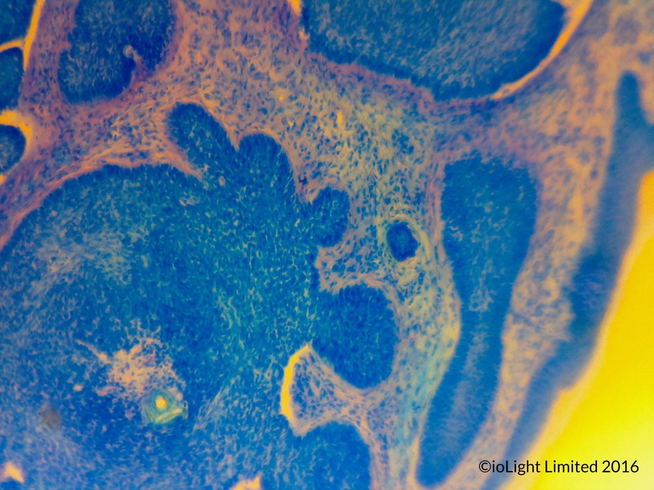 Digital USB Microscope images from the ioLight pocket microscope