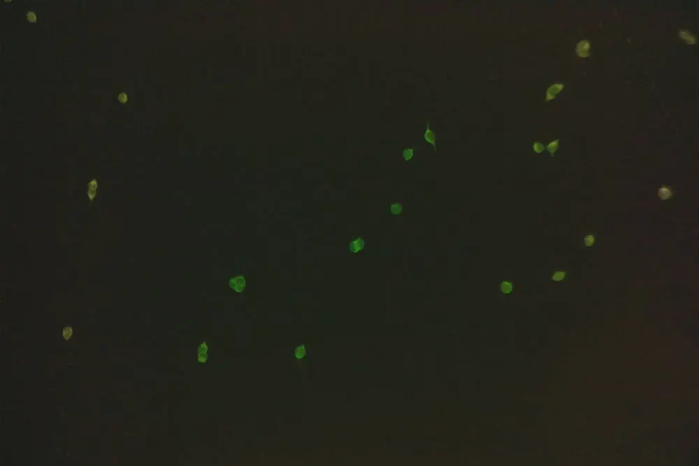 CCI-Blue-excitation-Dual-Colour-Fluorescence-iolight CCI-Blue-excitation-Dual-Colour-Fluorescence-iolight