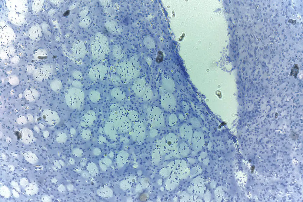 CCI-Brightfield-Dual-Colour-Fluorescence-iolight CCI-Brightfield-Dual-Colour-Fluorescence-iolight