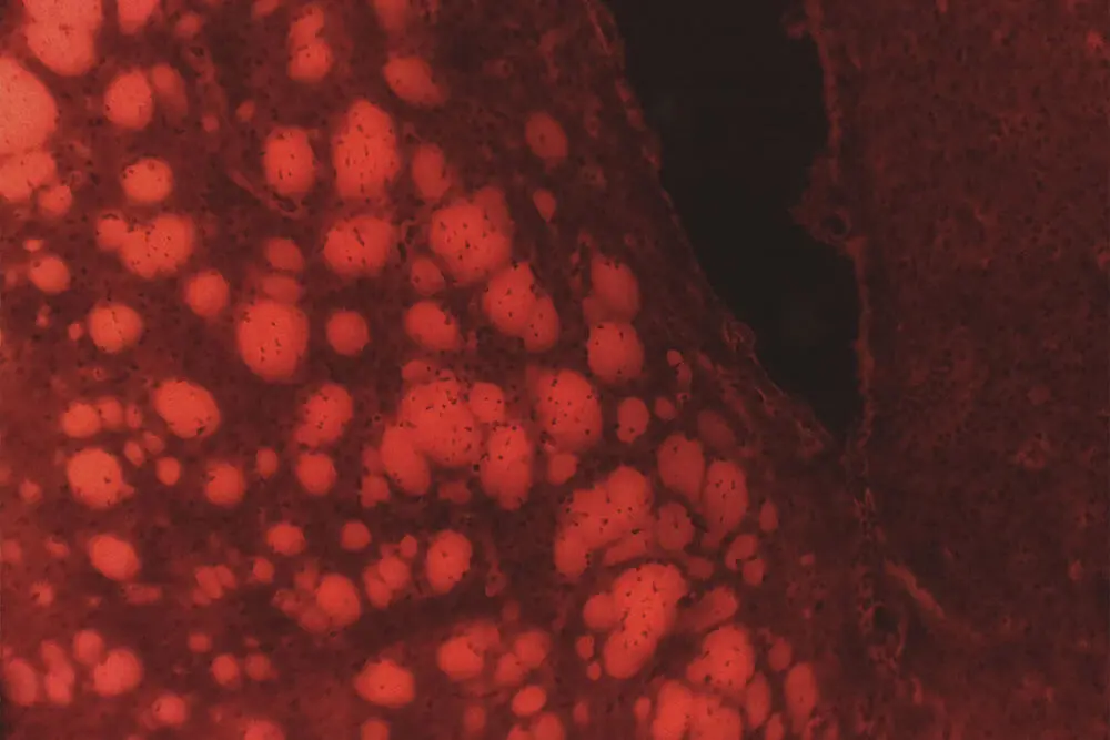 CCI-Green-excitation-Dual-Colour-Fluorescence-iolight CCI-Green-excitation-Dual-Colour-Fluorescence-iolight